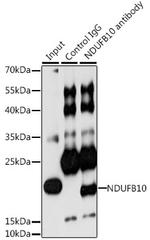 NDUFB10 Antibody in Immunoprecipitation (IP)