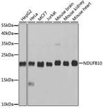 NDUFB10 Polyclonal Antibody