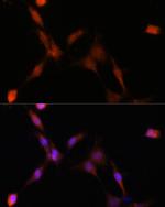 PSMA7 Antibody in Immunocytochemistry (ICC/IF)