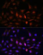 PSMA7 Antibody in Immunocytochemistry (ICC/IF)