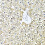 PSMA7 Antibody in Immunohistochemistry (Paraffin) (IHC (P))