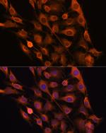 RNH1 Antibody in Immunocytochemistry (ICC/IF)