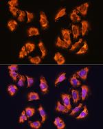 Alpha Sarcoglycan Antibody in Immunocytochemistry (ICC/IF)