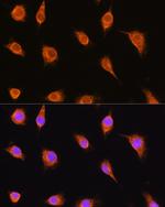 Alpha Sarcoglycan Polyclonal Antibody