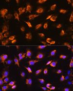 Alpha Sarcoglycan Antibody in Immunocytochemistry (ICC/IF)