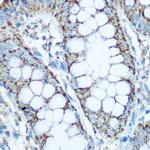 UQCRC2 Polyclonal Antibody