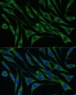 VARS Polyclonal Antibody