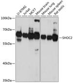 SHOC2 Polyclonal Antibody