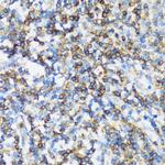 ARHGEF1 Polyclonal Antibody