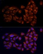 RPH3AL Antibody in Immunocytochemistry (ICC/IF)