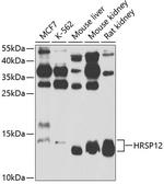 HRSP12 Antibody in Western Blot (WB)