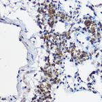 MYBBP1A Antibody in Immunohistochemistry (Paraffin) (IHC (P))