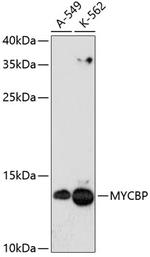 MYCBP Antibody in Western Blot (WB)