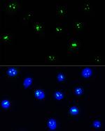 NOP58 Antibody in Immunocytochemistry (ICC/IF)
