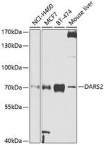 AspRS Antibody in Western Blot (WB)