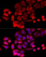PIDD Antibody in Immunocytochemistry (ICC/IF)