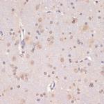 PIDD Antibody in Immunohistochemistry (Paraffin) (IHC (P))