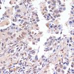 PIDD Antibody in Immunohistochemistry (Paraffin) (IHC (P))