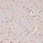 PIDD Antibody in Immunohistochemistry (Paraffin) (IHC (P))
