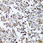 GARS Antibody in Immunohistochemistry (Paraffin) (IHC (P))