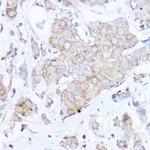 MGP Polyclonal Antibody