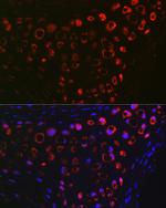 MGP Antibody in Immunohistochemistry (Paraffin) (IHC (P))