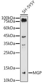 MGP Antibody in Western Blot (WB)