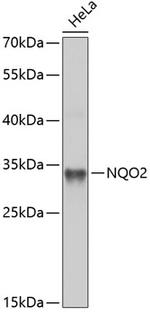 NQO2 Antibody in Western Blot (WB)