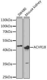 ACVR1B Polyclonal Antibody