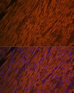 MYL2 Antibody in Immunohistochemistry (Paraffin) (IHC (P))