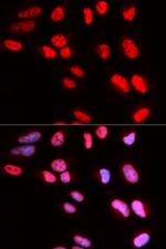 PRPF3 Polyclonal Antibody