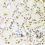 PRPF3 Antibody in Immunohistochemistry (Paraffin) (IHC (P))