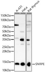 SNRPE Antibody in Western Blot (WB)