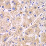 TrxR2 Antibody in Immunohistochemistry (Paraffin) (IHC (P))
