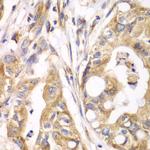TrxR2 Antibody in Immunohistochemistry (Paraffin) (IHC (P))