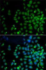 UBD Polyclonal Antibody