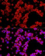 ALDH3A1 Antibody in Immunocytochemistry (ICC/IF)