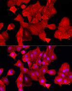 ALDH3A1 Polyclonal Antibody