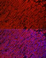 ALDH3A1 Antibody in Immunohistochemistry (Paraffin) (IHC (P))