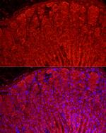 ALDH3A1 Antibody in Immunohistochemistry (Paraffin) (IHC (P))