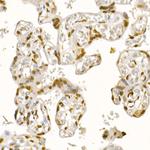 AKT1 Antibody in Immunohistochemistry (Paraffin) (IHC (P))