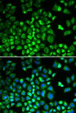 HAX1 Polyclonal Antibody