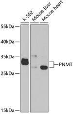 PNMT Polyclonal Antibody