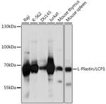L-Plastin Polyclonal Antibody