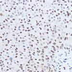 SKIV2L2 Polyclonal Antibody