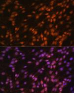 FUBP1 Polyclonal Antibody