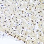FUBP1 Antibody in Immunohistochemistry (Paraffin) (IHC (P))
