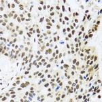 FUBP1 Antibody in Immunohistochemistry (Paraffin) (IHC (P))
