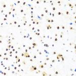 FUBP1 Antibody in Immunohistochemistry (Paraffin) (IHC (P))