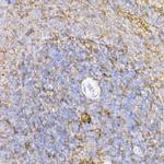 ICAM-1 Antibody in Immunohistochemistry (Paraffin) (IHC (P))